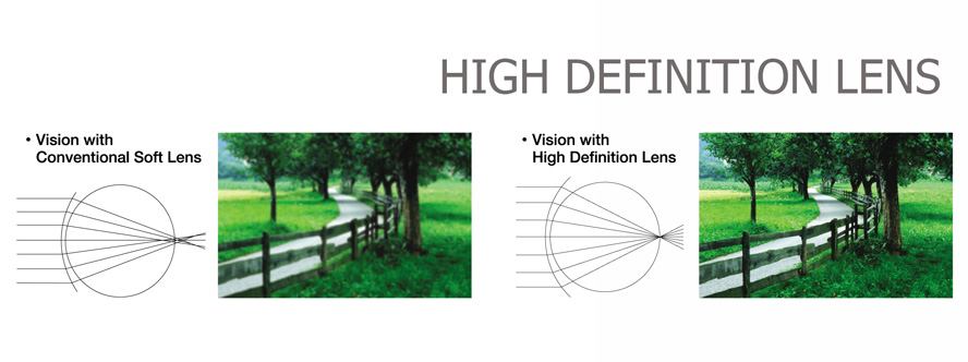 high definition vision в линзах ADRIA